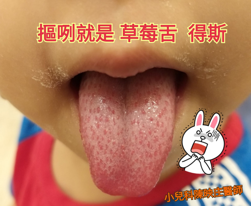 草莓舌