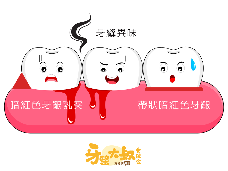 如何消除牙齦發炎